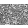 Human Tonsil Epithelial Cells (HTEpiC) - Phase contrast, 200x.
