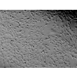 Human Tonsil Fibroblasts (HTF) - Relief contrast, 100x.
