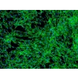 Human Tonsil Fibroblasts (HTF) - Immunostaining for Fibronectin, 100x.
