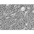 Human Tracheal Epithelial Cells (HTEpiC) - Phase contrast, 200x.
