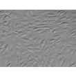 Human Umbilical Artery Endothelial Cells (HUAEC) - Relief contrast, 400x.
