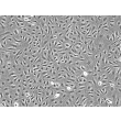 Human Umbilical Artery Endothelial Cells (HUAEC) - Phase contrast, 100x.
