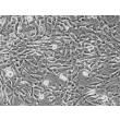 Human Umbillical Artery Smooth Muscle Cells (HUASMC) - Phase contrast, 200x.
