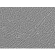 Human Umbilical Vein Smooth Muscle Cells (HUVSMC) - Immunostaining for α-SMA, 400x.
