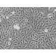 Human Urothelial Cells (HUC) - Phase contrast, 200x.

