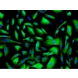 Human Urothelial Cells (HUC) - Immunostaining for CK-19, 200x.
