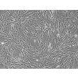 Human Uterine Fibroblasts (HUF)-Phase Contrast, 100x.
