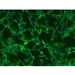 Human Uterine Fibroblasts (HUF)-Immunostaining for Fibronectin, 200x.
