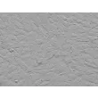 Human Vertebral Mesenchymal Stem Cells (HVMSC) - Relief contrast, 200x.
