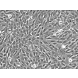 Human Vertebral Mesenchymal Stem Cells (HVMSC) - Phase contrast, 200x.
