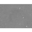 Mouse Brain Vascular Pericytes (MBVP)-Phase contrast, 100x.
