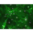 Mouse Brain Vascular Pericytes (MBVP)-Immunostaining for PDGF Receptor-Beta, 200x
