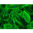 Mouse Brain Vascular Pericytes (MBVP)-Immunostaining for α-SMA, 200x
