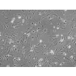Mouse Cardiac Myocytes (MCM) - Phase contrast, 100x.
