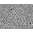 Mouse Cerebellar Granule Cells (MGC) - Relief contrast, 400x.
