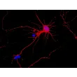 Mouse Cerebellar Granule Cells (MGC) - Immunostaining for β-Tubulin III, 600x.
