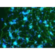 Mouse Cerebellar Granule Cells (MGC) - Immunostaining for β-Tubulin III, 200x.
