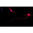 Mouse Cerebellar Granule Cells (MGC) - Immunostaining for β-Tubulin III, 400x.
