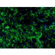 Mouse Embryonic Fibroblasts (MEF) - Immunostaining for Fibronectin, 200X.
