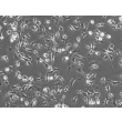 Mouse Hepatic Macrophages (MHMa)-Phase Contrast, 200x
