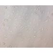 Mouse Hepatic Mesothelial Cells (MHMeC) - Relief Contrast, 200x