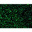 Mouse Hepatic Mesothelial Cells (MHMeC) - Immunostaining for Mesothelin, 200x