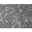 Mouse Hepatic Mesothelial Cells (MHMeC) - Phase Contrast, 100x