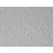 Mouse Lymphatic Fibroblasts (MLF) – Relief Contrast, 200x
