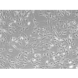 Mouse Lymphatic Fibroblasts (MLF) – Phase Contrast, 100x
