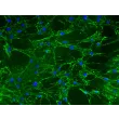 Mouse Lymphatic Fibroblasts (MLF) – Immunostaining for Fibronectin, 200x
