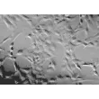 Mouse Meningeal Cells (MMenC) - Relief contrast, 200x.
