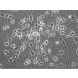 Mouse Neurons-cortical (MN-c) - Phase contrast, 400x.
