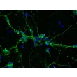 Mouse Neurons-striatal (MN-s)  - Immunostaining for β-tubulin III, 400x