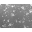 Mouse Neurons-striatal (MN-s) - Phase Contrast, 100x