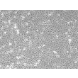 Mouse Renal Proximal Tubular Epithelial Cells (MRPTEpiC) - Phase contrast, 100x.
