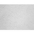 Rat Brain Vascular Pericytes (RBVP)-Relief Contrast, 200x.
