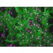 Rat Brain Vascular Pericytes (RBVP)-Immunostaining for α-SMA, 200x.
