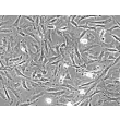 Rat Embryonic Fibroblasts (REF) - Phase contrast, 200x.
