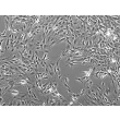 Rat Hepatic Stellate Cells-adult (RHSteC-a)-Phase contrast, 100x.
