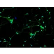 Rat Neurons-spinal cord (RN-sc) - Immunostaining for β-Tubulin III, 200x.
