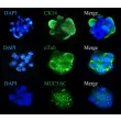 Human airway spheroids display the markers of basal cells (CK14), ciliated cells (acetylated ɑ-tubulin), and goblet cells (MUC5AC).
