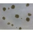 Ready-to-use Human Bronchial Fibroblast Spheroids