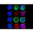 3D mini-kidneys display the epithelial cell marker CK18, the endothelial cell marker VWF, and the mesenchymal marker Vimentin. Notably, these spheroids also display high ACE2 expression.
