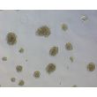 Human Ovarian Fibroblast Spheroids