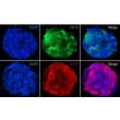 Spheroids display the differentiated epithelial cell marker CK-18. Notably, they also have high ACE2 expression, a receptor for SARS-CoV and SARS-CoV-2.
