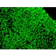hESC grown in STEMium – Immunostaining for OCT3/4 (green), 200x.
