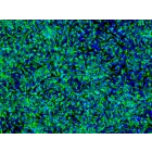 HiPSC-Derived Neural Stem Cells (HiPSC-NSC) - Immunostaining for Nestin, 200x
