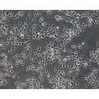 Human Pluripotent Stem Cell derived-Dopaminergic Neurons Phase Contrast 200X