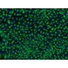 HPSC-Derived Neural Stem Cells (H9-NSC) – Immunostaining for Nestin, 200x