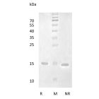 Recombinant Human Brain-Derived Neurotrophic Factor